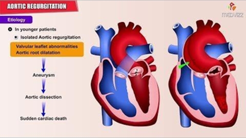  Etiology , Pathology , Diagnosis  and Treatment- USMLE