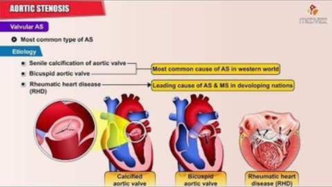 Causes , Symptoms , Pathology , Diagnosis and Treatment
